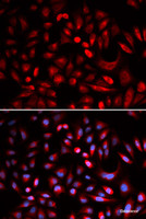 Immunofluorescence analysis of U2OS cells using PRKACB Polyclonal Antibody