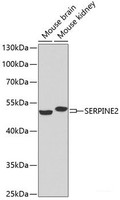 Western blot analysis of extracts of various cell lines using SERPINE2 Polyclonal Antibody at dilution of 1:1000.