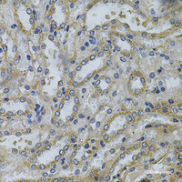 Immunohistochemistry of paraffin-embedded Mouse kidney using SERPINE2 Polyclonal Antibody at dilution of 1:100 (40x lens) .