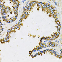 Immunohistochemistry of paraffin-embedded Human prostate using EFNA1 Polyclonal Antibody at dilution of 1:100 (40x lens) .