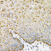 Immunohistochemistry of paraffin-embedded Human esophagus using EFNA1 Polyclonal Antibody at dilution of 1:100 (40x lens) .