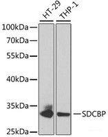 Western blot analysis of extracts of various cell lines using SDCBP Polyclonal Antibody at dilution of 1:1000.