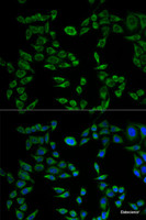 Immunofluorescence analysis of HeLa cells using VAPB Polyclonal Antibody