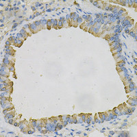 Immunohistochemistry of paraffin-embedded Mouse lung using AZGP1 Polyclonal Antibody at dilution of 1:100 (40x lens) .