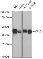 Western blot analysis of extracts of various cell lines using CALD1 Polyclonal Antibody at dilution of 1:1000.