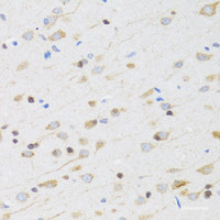 Immunohistochemistry of paraffin-embedded Rat brain using CHRM5 Polyclonal Antibody at dilution of 1:100 (40x lens) .