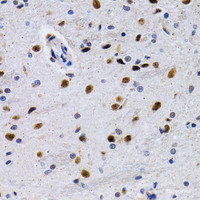 Immunohistochemistry of paraffin-embedded Rat brain using ID3 Polyclonal Antibody at dilution of 1:200 (40x lens) .