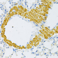 Immunohistochemistry of paraffin-embedded Mouse lung using TYROBP Polyclonal Antibody at dilution of 1:100 (40x lens) .