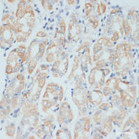 Immunohistochemistry of paraffin-embedded Human stomach using ADAM9 Polyclonal Antibody at dilution of 1:100 (40x lens) .