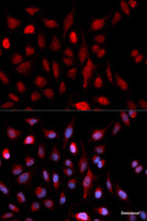 Immunofluorescence analysis of U2OS cells using ASH2L Polyclonal Antibody