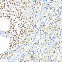 Immunohistochemistry of paraffin-embedded Rat ovary using BACH1 Polyclonal Antibody at dilution of 1:100 (40x lens) .