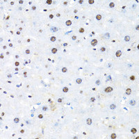 Immunohistochemistry of paraffin-embedded Mouse liver using BACH1 Polyclonal Antibody at dilution of 1:100 (40x lens) .