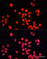 Immunofluorescence analysis of HeLa cells using BACH1 Polyclonal Antibody at dilution of 1:100. Blue: DAPI for nuclear staining.