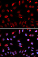 Immunofluorescence analysis of U2OS cells using HUS1 Polyclonal Antibody