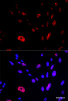 Immunofluorescence analysis of U2OS cells using HUS1 Polyclonal Antibody