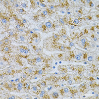 Immunohistochemistry of paraffin-embedded Human liver damage using NPC2 Polyclonal Antibody at dilution of 1:100 (40x lens) .