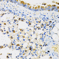 Immunohistochemistry of paraffin-embedded Mouse lung using NPC2 Polyclonal Antibody at dilution of 1:100 (40x lens) .