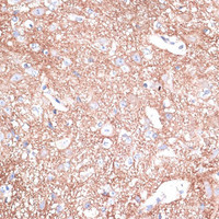 Immunohistochemistry of paraffin-embedded Mouse spinal cord using STXBP1 Polyclonal Antibody at dilution of 1:100 (40x lens) .