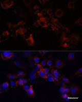 Immunofluorescence analysis of NIH/3T3 cells using STXBP1 Polyclonal Antibody at dilution of 1:100 (40x lens) . Blue: DAPI for nuclear staining.