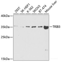 Western blot analysis of extracts of various cell lines using TRIB3 Polyclonal Antibody at dilution of 1:1000.