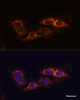 Immunofluorescence analysis of C6 cells using RIP3 Polyclonal Antibody at dilution of 1:100. Blue: DAPI for nuclear staining.