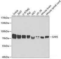 Western blot analysis of extracts of various cell lines using GARS Polyclonal Antibody at dilution of 1:5000.