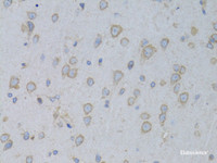 Immunohistochemistry of paraffin-embedded Rat brain using GARS Polyclonal Antibody at dilution of 1:100 (40x lens) .