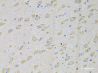 Immunohistochemistry of paraffin-embedded Mouse brain using GARS Polyclonal Antibody at dilution of 1:100 (40x lens) .