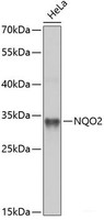 Western blot analysis of extracts of HeLa cells using NQO2 Polyclonal Antibody at dilution of 1:1000.