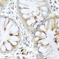 Immunohistochemistry of paraffin-embedded Human colon using PI3 Polyclonal Antibody at dilution of 1:100 (40x lens) .