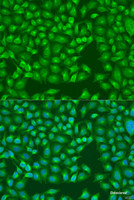 Immunofluorescence analysis of U2OS cells using MERTK Polyclonal Antibody at dilution of 1:100. Blue: DAPI for nuclear staining.