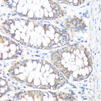 Immunohistochemistry of paraffin-embedded Human colon using HSD17B10 Polyclonal Antibody at dilution of 1:100 (40x lens) .