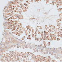 Immunohistochemistry of paraffin-embedded Rat testis using KIF2C Polyclonal Antibody at dilution of 1:100 (40x lens) .