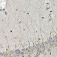 Immunohistochemistry of paraffin-embedded Rat brain using PSMB10 Polyclonal Antibody at dilution of 1:200 (40x lens) .