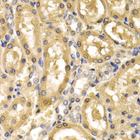 Immunohistochemistry of paraffin-embedded Rat kidney using ADH4 Polyclonal Antibody at dilution of 1:200 (40x lens) .