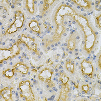 Immunohistochemistry of paraffin-embedded Mouse kidney using FHL1 Polyclonal Antibody at dilution of 1:100 (40x lens) .