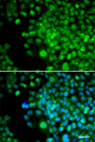 Immunofluorescence analysis of HeLa cells using FHL1 Polyclonal Antibody