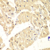Immunohistochemistry of paraffin-embedded Mouse heart using HIF1AN Polyclonal Antibody at dilution of 1:100 (40x lens) .