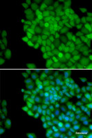 Immunofluorescence analysis of HeLa cells using MAGEA1 Polyclonal Antibody