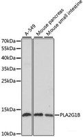 Western blot analysis of extracts of various cell lines using PLA2G1B Polyclonal Antibody at dilution of 1:1000.