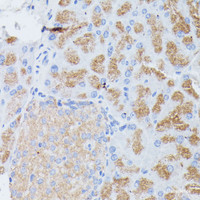 Immunohistochemistry of paraffin-embedded Mouse pancreas using PLA2G1B Polyclonal Antibody at dilution of 1:100 (40x lens) .