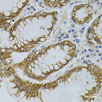 Immunohistochemistry of paraffin-embedded Human stomach using SIGMAR1 Polyclonal Antibody