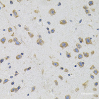 Immunohistochemistry of paraffin-embedded Mouse brain using SIGMAR1 Polyclonal Antibody