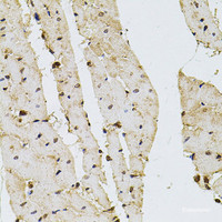 Immunohistochemistry of paraffin-embedded Rat heart using PPP2R5C Polyclonal Antibody at dilution of 1:100 (40x lens) .