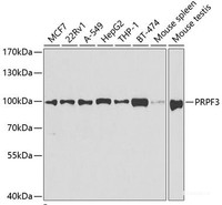 Western blot analysis of extracts of various cell lines using PRPF3 Polyclonal Antibody at dilution of 1:1000.