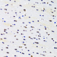 Immunohistochemistry of paraffin-embedded Rat brain using PRPF3 Polyclonal Antibody at dilution of 1:100 (40x lens) .