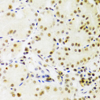Immunohistochemistry of paraffin-embedded Human stomach using PRPF3 Polyclonal Antibody at dilution of 1:100 (40x lens) .