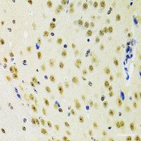 Immunohistochemistry of paraffin-embedded Mouse brain using PRPF3 Polyclonal Antibody at dilution of 1:100 (40x lens) .