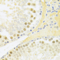 Immunohistochemistry of paraffin-embedded Rat testis using RFC4 Polyclonal Antibody at dilution of 1:100 (40x lens) .