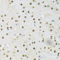 Immunohistochemistry of paraffin-embedded Mouse brain using SNRPE Polyclonal Antibody at dilution of 1:200 (40x lens) .